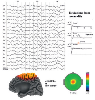 Deviations from normality