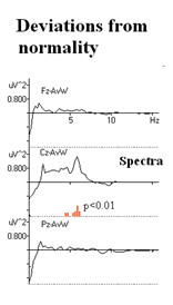 ������� ����